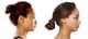 Slider image (10) JK Plastic Surgery Korea Aesthetic Surgery Clinic